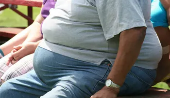 La gravedad de la COVID-19 aumenta en pacientes con obesidad incluso moderada