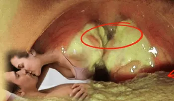 ADVERTENCIA !! No besen a todos los todos el que te diga ¡Hola .! Nuevo Virus mata más rápido que el Sida!