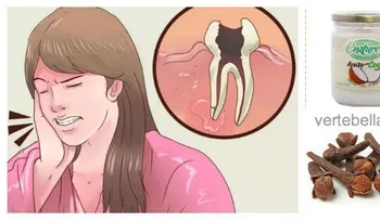 Con este remedio podrás calmar el dolor de muelas