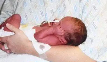 Mujer con dos vaginas dio a luz a dos niños
