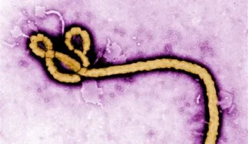 Detectan ébola en el ojo de un paciente curado 