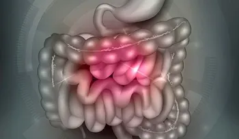 Colon irritado sus causas y remedios para tratarlo