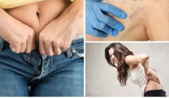 9 problemas por usar ropa demasiado ajustada