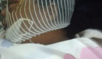 Mujer lanza ácido del diablo a otra