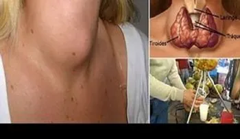 Otros temas de salud exclusivos 