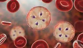 Si sientes fiebre, dolores musculares o de cabeza, podría ser babesiosis, enfermedad transmitida por garrapatas