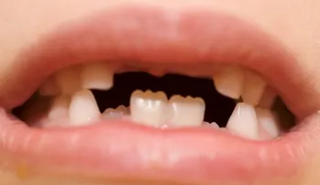 Consejos sencillos para unos dientes sanos en los niños