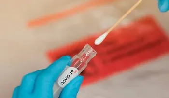 Pacientes dominicanos en cuidados intensivos por coronavirus, han logrado mejoría con Tocilizumab (Actemra) 