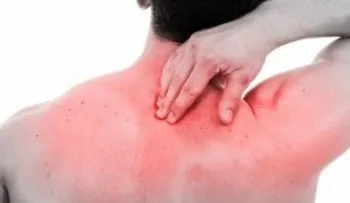 Registran 64 casos de extraña mialgia que deja la orina negra