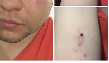 Apuñalan en un brazo al cantante Luifer Cuello para robarle
