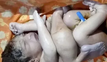 Nace bebé con 4 piernas, 3 manos y 2 penes