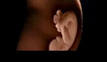 Amnistía repudia penalización del aborto en RD