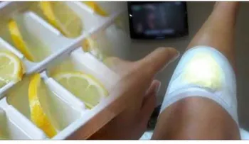 Pon un limón de esta manera en tus rodillas y termina con el dolor definitivamente