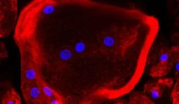 Encuentran la clave para prevenir la metástasis del cáncer de mama