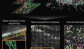 Diseñan un "mapa google" que permitirá avanzar en investigación del alzhéimer, el cáncer y otras enfermedades complejas