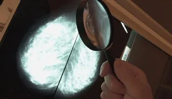 Cáncer será diagnosticado con teléfonos inteligentes