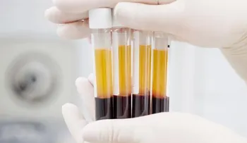 Hallan un biomarcador que permite predecir el cáncer de riñón