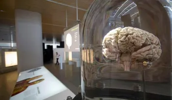  Hallan un método "menos invasivo" para estimular el cerebro mediante luz 