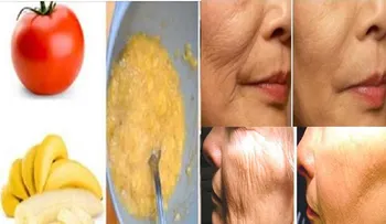 Diga adiós a la arruga facial en sólo 3 días con este remedio casero!