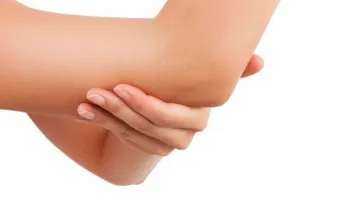 ¡No dejes de probarla! Aclara los codos y rodillas con esta crema casera 