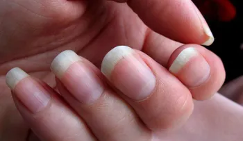 Cambios en las uñas que te muestran problemas de salud