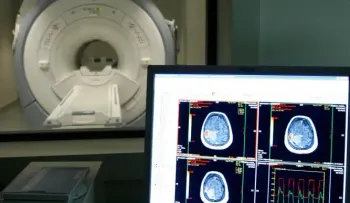 Chilenos proponen tratamiento contra el alzhéimer con nanopartículas de oro