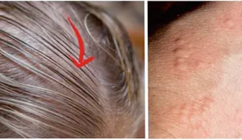 8 señales que indican que sufres de la tiroides