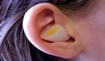 Mira que pasa con un trozo de cebolla en el oído: descubre 10 sorprendentes propiedades 