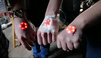 Ã?ltima Moda. Implantes de luces LED