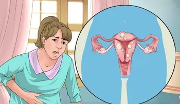 Los 4 trastornos menstruales y remedios que son muy EFECTIVOS 