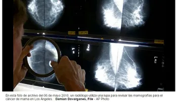 Estudio muestra ventaja de tratamiento para cáncer de mama 