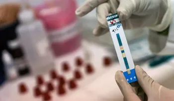 El VIH se podrá prevenir con una vacuna y un implante subcutáneo 