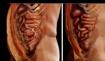 Después que lo tome jamás volverás a ENGORDAR. Te limpia el intestino y elimina impurezas del cuerpo
