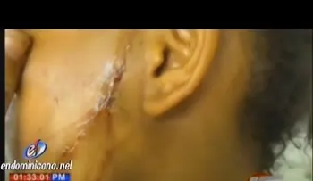 Una estudiante le corta la cara a otra por "pedirle disculpas" (VIDEO)