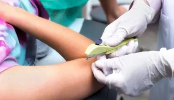 Implante anticonceptivo: ¿Cómo funciona y cuánto tiempo dura?