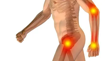 10 alimentos que nunca debes comer si tienes dolor en las articulaciones