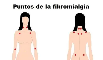Los mejores ejercicios para la fibromialgia