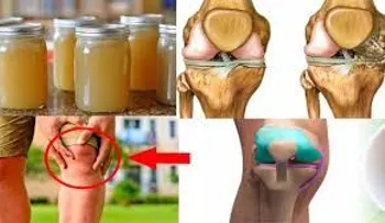 Poderoso remedio para el dolor de rodillas, huesos y articulaciones