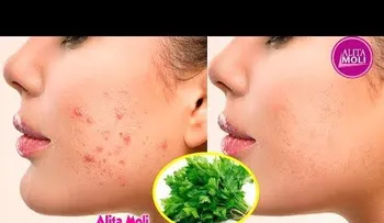 Increíble mascarilla con perejil para arrugas, manchas y acné
