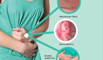 Anote estos remedios para la gastritis
