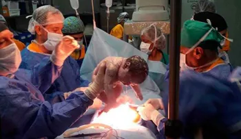 Increíble operación: sacan del útero de su madre bebé de seis meses, curan su médula espinal y lo vuelven a colocar