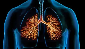 Hallan una vacuna contra la bronquiolitis y la neumonía 