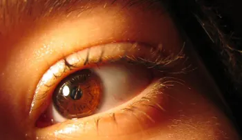 Retinopatía diabética, mal silencioso que afecta a uno de cada tres pacientes