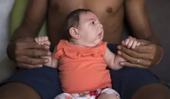 Nace en Hawaii un bebé con el virus zika