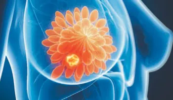 Identifican moléculas que crean resistencia a tratamientos del cáncer de mama