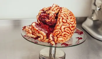 El extraño caso del hombre que vive sin el 90% de su cerebro