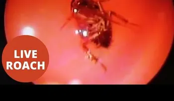 FUERTE VIDEO: Extraen una cucaracha viva de la cabeza de una mujer
