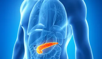 El cáncer de páncreas es de diagnóstico tardío