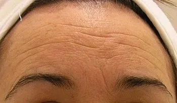 Crema casera para eliminar arrugas en solo 7 días: ¡A lucir más joven y bella!