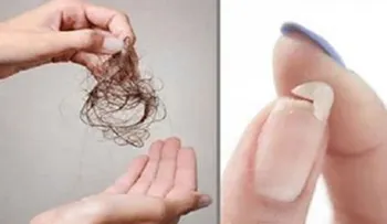 16 remedios que funcionan para curar la insuficiencia Suprarrenal
